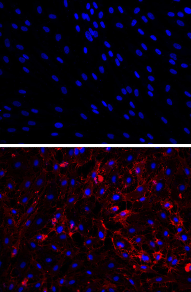 Photo: Jack Wong, Houston Methodist Research Institute Scar cells (top, nuclei stained blue) are coaxed into becoming blood vessel cells with a new, small-molecule and protein therapy. Evidence of the conversion is shown in the second panel (bottom), where red staining indicates the presence of CD31, a protein made by blood vessel cells. In a new Circulation paper, Houston Methodist scientists report these transformed cells self-assembled into vessels that improved blood flow.