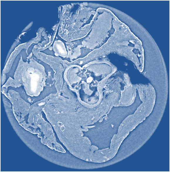 Phase-contrast imaging is a technique for scanning the volumes of soft tissues like tumors or internal organs, but with much greater contrast than conventional CT scans. This image shows a non-invasive "slice" of a rat's heart tissue made with X-ray phase tomography by propagation-based imaging, which provides sharper data with higher resolution than phase tomography using X-ray grating interferometry (photo:Irene Zanette/Technische Universität München). 