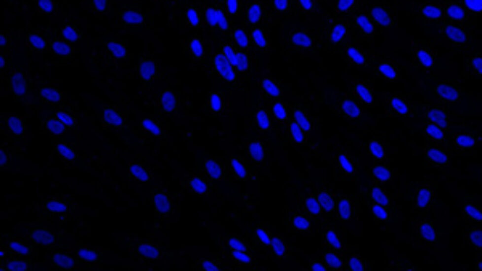 reprogrammed cells 21